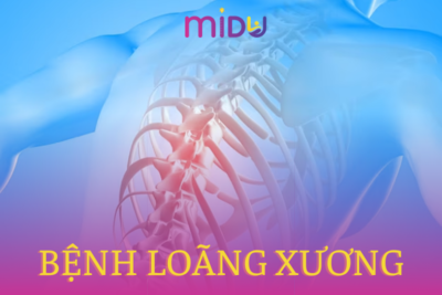 Bệnh loãng xương - 5 giai đoạn của bệnh loãng xương là gì?
